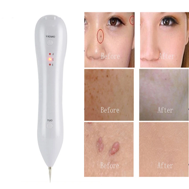 Online Get Cheap Tattoo Removal -Aliexpress.com | Alibaba